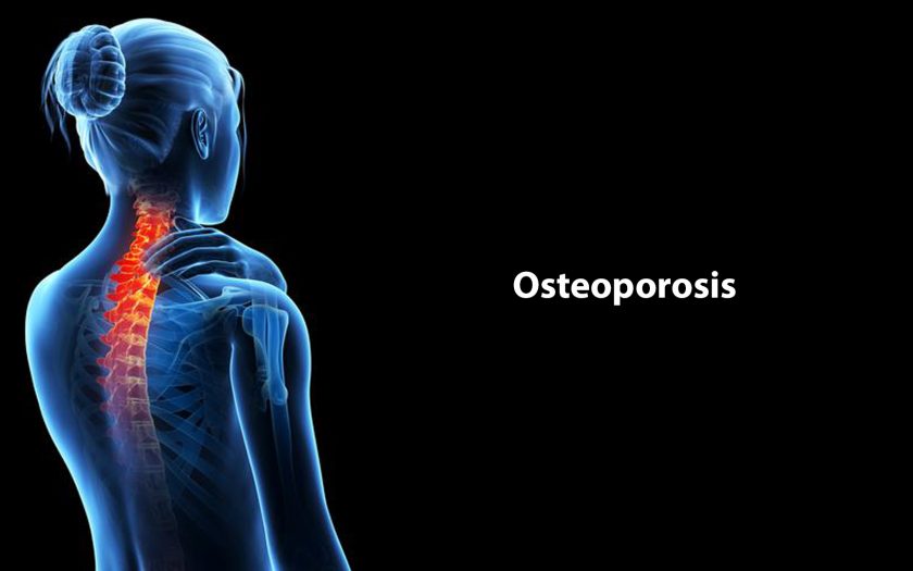 osteoporosis