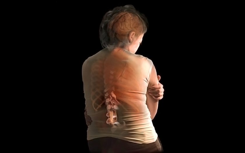 osteoporosis